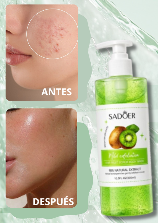 🥝 Gel Exfoliante Corporal y Facial de Kiwi SADOER (300 ml)